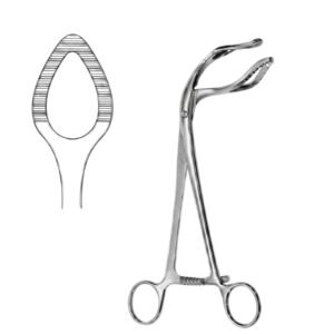 Surgical Gynecology Probe Device