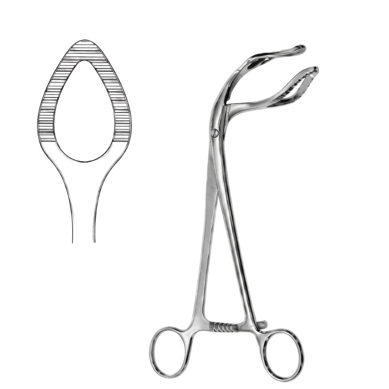 Surgical Gynecology Probe Device Surgical Gynecology Probe Device